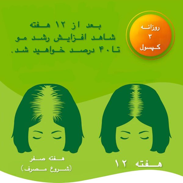 کپسول‌های PRIORIN Bayer – مکمل تخصصی برای تقویت رشد مو و کاهش ریزش موی ارثی و هورمونی، حاوی ترکیبات مغذی برای سلامت فولیکول‌های مو.